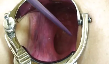 Culo rosso video amatoriali erotici gratis uncrossed lei gambe